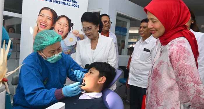 Gelar BKGN 2025 di Bali Soroti Penyakit Gusi Sebagai ‘Silent Killer’